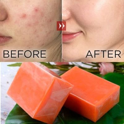 バギナ ストレッチ 脱毒 ヨーニ 漂白 石けん 薬剤 持たない 2 年 保存期間