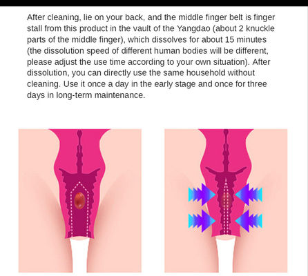 1.5g バジナル・ストレッチングカプセル 女性衛生とストレッチに対する完璧な解決策